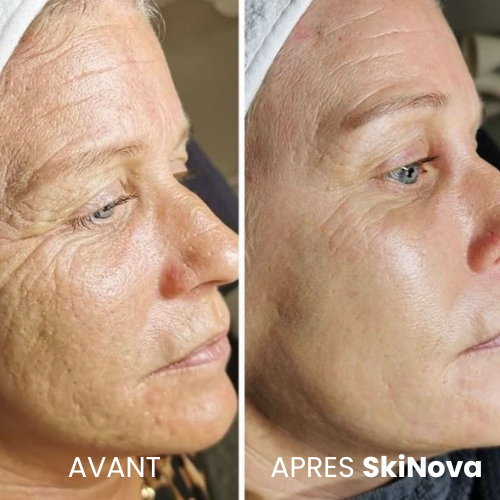Stylo DermaRepair SkiNova™