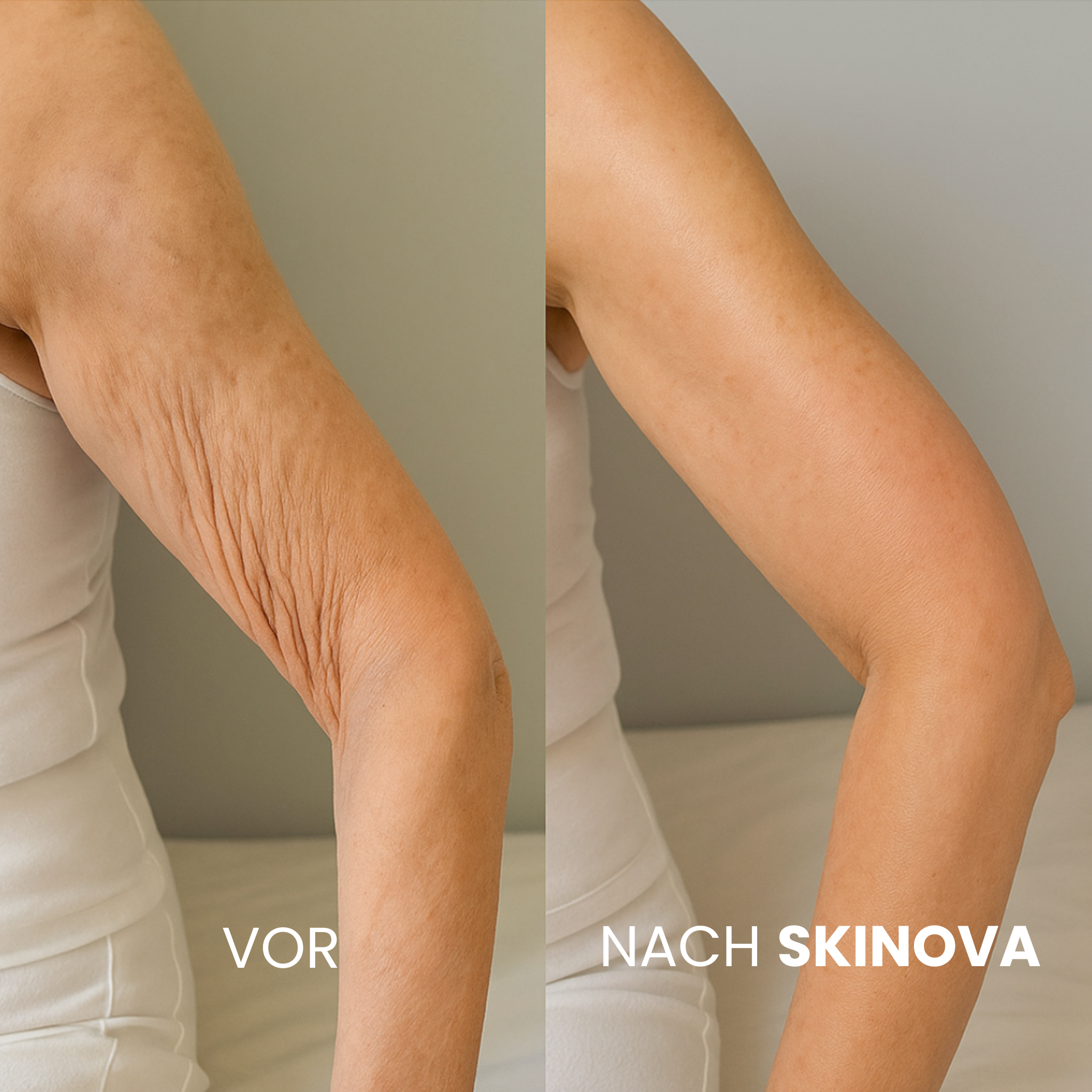 Novera - Verjüngendes Körperöl